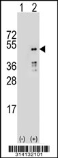 Western blot analysis of his-tag ACTL6B (arrow) using his tag antibody. 293 cell lysates (2 ug/lane) either nontransfected (Lane 1) or transiently transfected with the ACTL6B gene.