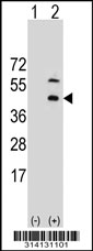 Western blot analysis of his-tag PAICS (arrow) using his tag antibody. 293 cell lysates (2 ug/lane) either nontransfected (Lane 1) or transiently transfected with the PAICS gene.