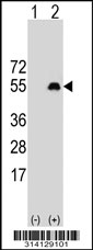 Western blot analysis of his-tag RBM23 (arrow) using his tag antibody. 293 cell lysates (2 ug/lane) either nontransfected (Lane 1) or transiently transfected with the RBM23 gene.