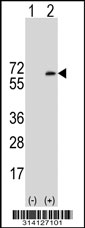 Western blot analysis of his-tag B3GALT2 (arrow) using his tag antibody. 293 cell lysates (2 ug/lane) either nontransfected (Lane 1) or transiently transfected with the B3GALT2 gene.