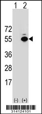 Western blot analysis of his-tag FAM172A (arrow) using his tag antibody. 293 cell lysates (2 ug/lane) either nontransfected (Lane 1) or transiently transfected with the FAM172A gene.