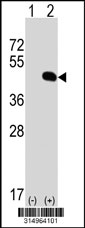 Western blot analysis of his-tag WDR89 (arrow) using his tag antibody. 293T cell lysates (2 ug/lane) either nontransfected (Lane 1) or transiently transfected with the WDR89 gene‘