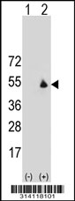 Western blot analysis of his-tag CCDC67 (arrow) using his tag antibody. 293 cell lysates (2 ug/lane) either nontransfected (Lane 1) or transiently transfected with the CCDC67 gene.