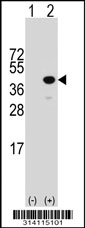 Western blot analysis of his-tag DCPS (arrow) using his tag antibody. 293 cell lysates (2 ug/lane) either nontransfected (Lane 1) or transiently transfected with the DCPS gene.