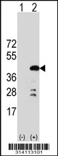 Western blot analysis of his-tag DNAJB4 (arrow) using his tag antibody. 293 cell lysates (2 ug/lane) either nontransfected (Lane 1) or transiently transfected with the DNAJB4 gene.
