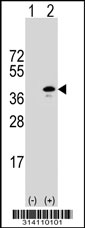 Western blot analysis of his-tag RNF2 (arrow) using his tag antibody. 293 cell lysates (2 ug/lane) either nontransfected (Lane 1) or transiently transfected with the RNF2 gene.