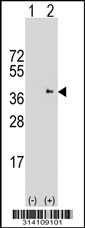 Western blot analysis of his-tag CCDC68 (arrow) using his tag antibody. 293 cell lysates (2 ug/lane) either nontransfected (Lane 1) or transiently transfected with the CCDC68 gene.
