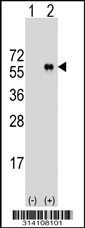 Western blot analysis of his-tag PROCA1 (arrow) using his tag antibody. 293 cell lysates (2 ug/lane) either nontransfected (Lane 1) or transiently transfected with the PROCA1 gene.
