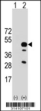 Western blot analysis of his-tag SPDEF (arrow) using his tag antibody. 293 cell lysates (2 ug/lane) either nontransfected (Lane 1) or transiently transfected with the SPDEF gene.
