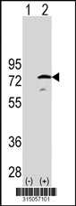 Western blot analysis of his-tag PGM2 (arrow) using his tag antibody. 293T cell lysates (2 ug/lane) either nontransfected (Lane 1) or transiently transfected with the PGM2 gene‘