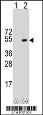 Western blot analysis of his-tag SF3B3 (arrow) using his tag antibody. 293 cell lysates (2 ug/lane) either nontransfected (Lane 1) or transiently transfected with the SF3B3 gene.