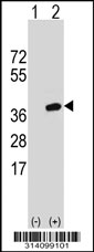 Western blot analysis of his-tag DDI1 (arrow) using his tag antibody. 293 cell lysates (2 ug/lane) either nontransfected (Lane 1) or transiently transfected with the DDI1 gene.
