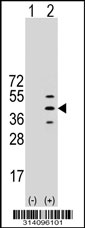 Western blot analysis of his-tag PAAF1 (arrow) using his tag antibody. 293 cell lysates (2 ug/lane) either nontransfected (Lane 1) or transiently transfected with the PAAF1 gene.