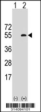 Western blot analysis of his-tag RASSF8 (arrow) using his tag antibody. 293 cell lysates (2 ug/lane) either nontransfected (Lane 1) or transiently transfected with the RASSF8 gene.