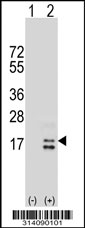 Western blot analysis of his-tag KRTCAP2 (arrow) using his tag antibody. 293 cell lysates (2 ug/lane) either nontransfected (Lane 1) or transiently transfected with the KRTCAP2 gene.