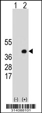 Western blot analysis of his-tag FOXS1 (arrow) using his tag antibody. 293 cell lysates (2 ug/lane) either nontransfected (Lane 1) or transiently transfected with the FOXS1 gene.