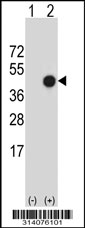 Western blot analysis of his-tag KTELC1 (arrow) using his tag antibody. 293 cell lysates (2 ug/lane) either nontransfected (Lane 1) or transiently transfected with the KTELC1 gene.