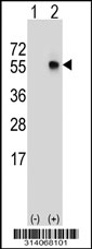 Western blot analysis of his-tag RNF13 (arrow) using his tag antibody. 293 cell lysates (2 ug/lane) either nontransfected (Lane 1) or transiently transfected with the RNF13 gene.