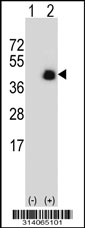 Western blot analysis of his-tag SERPINB9 (arrow) using his tag antibody. 293 cell lysates (2 ug/lane) either nontransfected (Lane 1) or transiently transfected with the SERPINB9 gene.