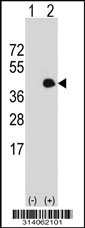 Western blot analysis of his-tag MECR (arrow) using his tag antibody. 293 cell lysates (2 ug/lane) either nontransfected (Lane 1) or transiently transfected with the MECR gene.