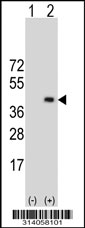 Western blot analysis of his-tag GMDS (arrow) using his tag antibody. 293 cell lysates (2 ug/lane) either nontransfected (Lane 1) or transiently transfected with the GMDS gene.