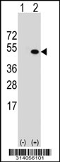 Western blot analysis of his-tag RRS1 (arrow) using his tag antibody. 293 cell lysates (2 ug/lane) either nontransfected (Lane 1) or transiently transfected with the RRS1 gene.