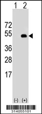Western blot analysis of his-tag BEND7 (arrow) using his tag antibody. 293 cell lysates (2 ug/lane) either nontransfected (Lane 1) or transiently transfected with the BEND7 gene.
