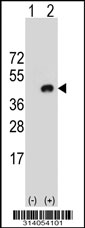 Western blot analysis of his-tag ZNF24 (arrow) using his tag antibody. 293 cell lysates (2 ug/lane) either nontransfected (Lane 1) or transiently transfected with the ZNF24 gene.