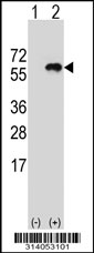 Western blot analysis of his-tag RIC3 (arrow) using his tag antibody. 293 cell lysates (2 ug/lane) either nontransfected (Lane 1) or transiently transfected with the RIC3 gene.