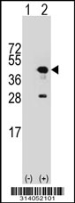 Western blot analysis of his-tag UROD (arrow) using his tag antibody. 293 cell lysates (2 ug/lane) either nontransfected (Lane 1) or transiently transfected with the UROD gene.