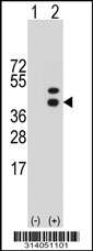 Western blot analysis of his-tag AFF4 (arrow) using his tag antibody. 293 cell lysates (2 ug/lane) either nontransfected (Lane 1) or transiently transfected with the AFF4 gene.