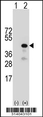 Western blot analysis of his-tag GMPPB (arrow) using his tag antibody. 293 cell lysates (2 ug/lane) either nontransfected (Lane 1) or transiently transfected with the GMPPB gene.