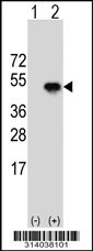 Western blot analysis of his-tag FKBP8 (arrow) using his tag antibody. 293 cell lysates (2 ug/lane) either nontransfected (Lane 1) or transiently transfected with the FKBP8 gene.