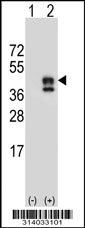 Western blot analysis of his-tag CHST11 (arrow) using his tag antibody. 293 cell lysates (2 ug/lane) either nontransfected (Lane 1) or transiently transfected with the CHST11 gene.