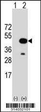Western blot analysis of his-tag SETMAR (arrow) using his tag antibody. 293 cell lysates (2 ug/lane) either nontransfected (Lane 1) or transiently transfected with the SETMAR gene.
