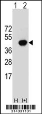 Western blot analysis of his-tag SIRT2 (arrow) using his tag antibody. 293 cell lysates (2 ug/lane) either nontransfected (Lane 1) or transiently transfected with the SIRT2 gene.
