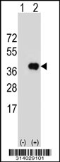 Western blot analysis of his-tag GPD1L (arrow) using his tag antibody. 293 cell lysates (2 ug/lane) either nontransfected (Lane 1) or transiently transfected with the GPD1L gene.