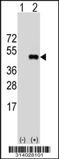 Western blot analysis of his-tag KLHDC8A (arrow) using his tag antibody. 293 cell lysates (2 ug/lane) either nontransfected (Lane 1) or transiently transfected with the KLHDC8A gene.