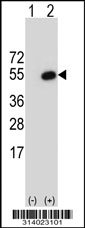 Western blot analysis of his-tag PLEK (arrow) using his tag antibody. 293 cell lysates (2 ug/lane) either nontransfected (Lane 1) or transiently transfected with the PLEK gene.