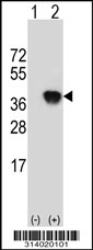 Western blot analysis of his-tag MRPL38 (arrow) using his tag antibody. 293 cell lysates (2 ug/lane) either nontransfected (Lane 1) or transiently transfected with the MRPL38 gene.