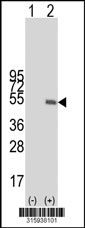 Western blot analysis of his-tag LOC348174 (arrow) using his tag antibody. 293T cell lysates (2 ug/lane) either nontransfected (Lane 1) or transiently transfected with the LOC348174 gene‘