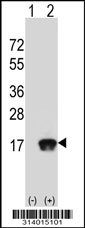 Western blot analysis of his-tag ATOH7 (arrow) using his tag antibody. 293 cell lysates (2 ug/lane) either nontransfected (Lane 1) or transiently transfected with the ATOH7 gene.