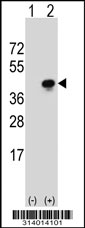 Western blot analysis of his-tag DHRS13 (arrow) using his tag antibody. 293 cell lysates (2 ug/lane) either nontransfected (Lane 1) or transiently transfected with the DHRS13 gene.