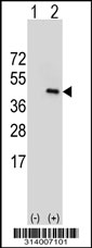 Western blot analysis of his-tag ANKRD1 (arrow) using his tag antibody. 293 cell lysates (2 ug/lane) either nontransfected (Lane 1) or transiently transfected with the ANKRD1 gene.
