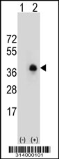 Western blot analysis of his-tag SPRY2 (arrow) using his tag antibody. 293 cell lysates (2 ug/lane) either nontransfected (Lane 1) or transiently transfected with the SPRY2 gene.