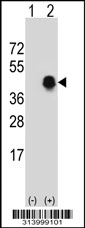 Western blot analysis of his-tag HSP90B1 (arrow) using his tag antibody. 293 cell lysates (2 ug/lane) either nontransfected (Lane 1) or transiently transfected with the HSP90B1 gene.