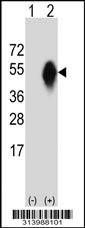 Western blot analysis of his-tag SLAMF7 (arrow) using his tag antibody. 293 cell lysates (2 ug/lane) either nontransfected (Lane 1) or transiently transfected with the SLAMF7 gene.