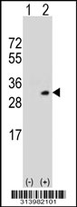 Western blot analysis of his-tag TFPI (arrow) using his tag antibody. 293 cell lysates (2 ug/lane) either nontransfected (Lane 1) or transiently transfected with the TFPI gene.