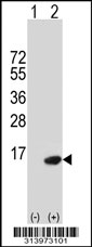 Western blot analysis of his-tag ERAF (arrow) using his tag antibody. 293 cell lysates (2 ug/lane) either nontransfected (Lane 1) or transiently transfected with the ERAF gene.