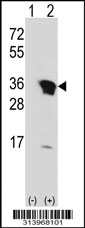 Western blot analysis of his-tag UNKL (arrow) using his tag antibody. 293 cell lysates (2 ug/lane) either nontransfected (Lane 1) or transiently transfected with the UNKL gene.